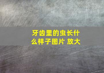 牙齿里的虫长什么样子图片 放大